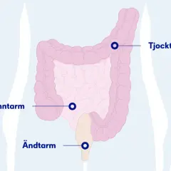 Illustration av tunntarm, tjocktarm och ändtarm. Om du har ont i nedre delen av magen kan det bero på problem i dessa organ.