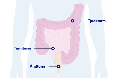 Illustration av tunntarm, tjocktarm och ändtarm. Om du har ont i nedre delen av magen kan det bero på problem i dessa organ.